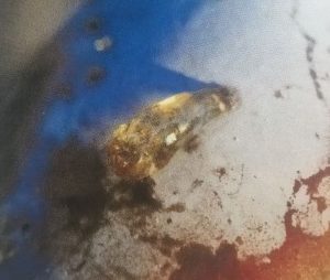 Gummitropfen an einer Pflaume – Symptom für Befall durch den Pflaumenwickler