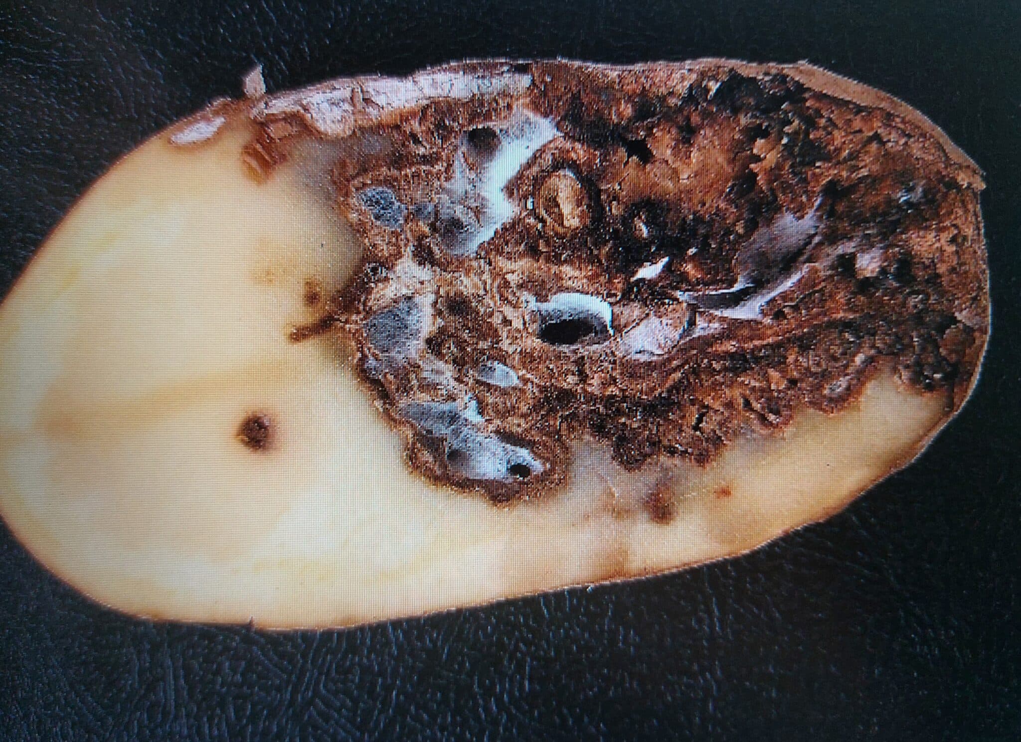 Fusarium-Knollenfäule der Kartoffel